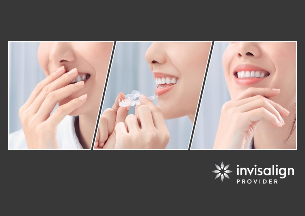invisalign invisible aligner - Imperial Dental Specialist Centre